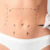 Google Ads Cosmetic Surgery Keywords