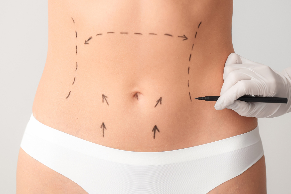 Google Ads Cosmetic Surgery Keywords