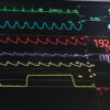 Core Web Vitals for WordPress