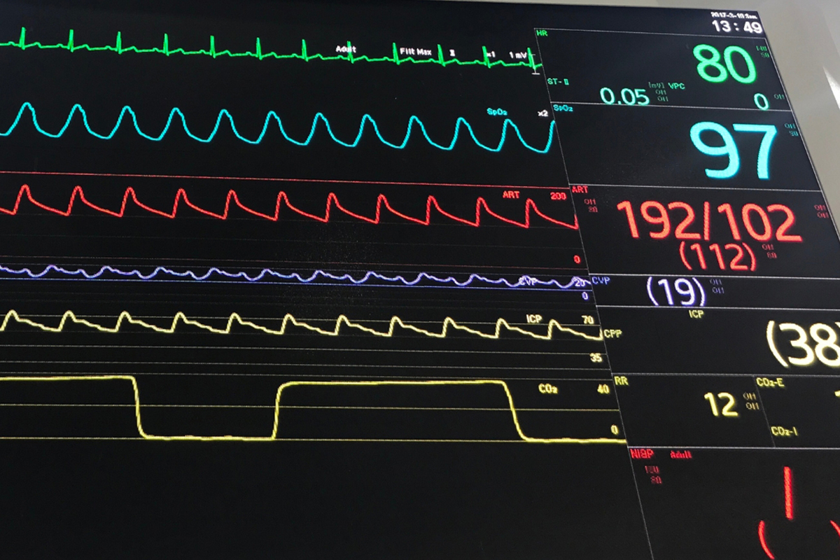 Core Web Vitals for WordPress